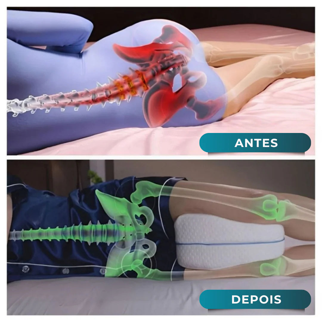Travesseiro Ortopédico para Pernas