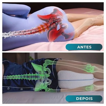 Travesseiro Ortopédico para Pernas