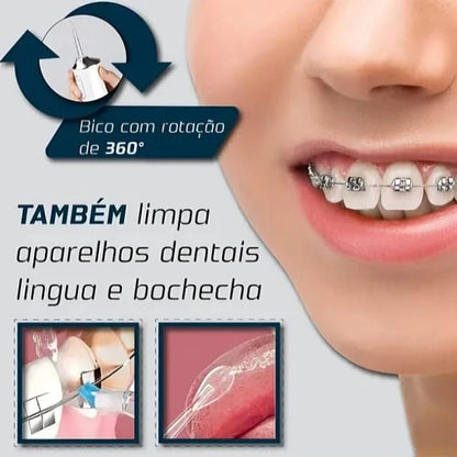 Irrigador Dental Portátil Recarregável